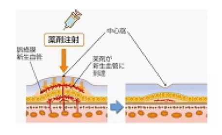 治療法