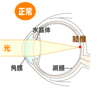 正常